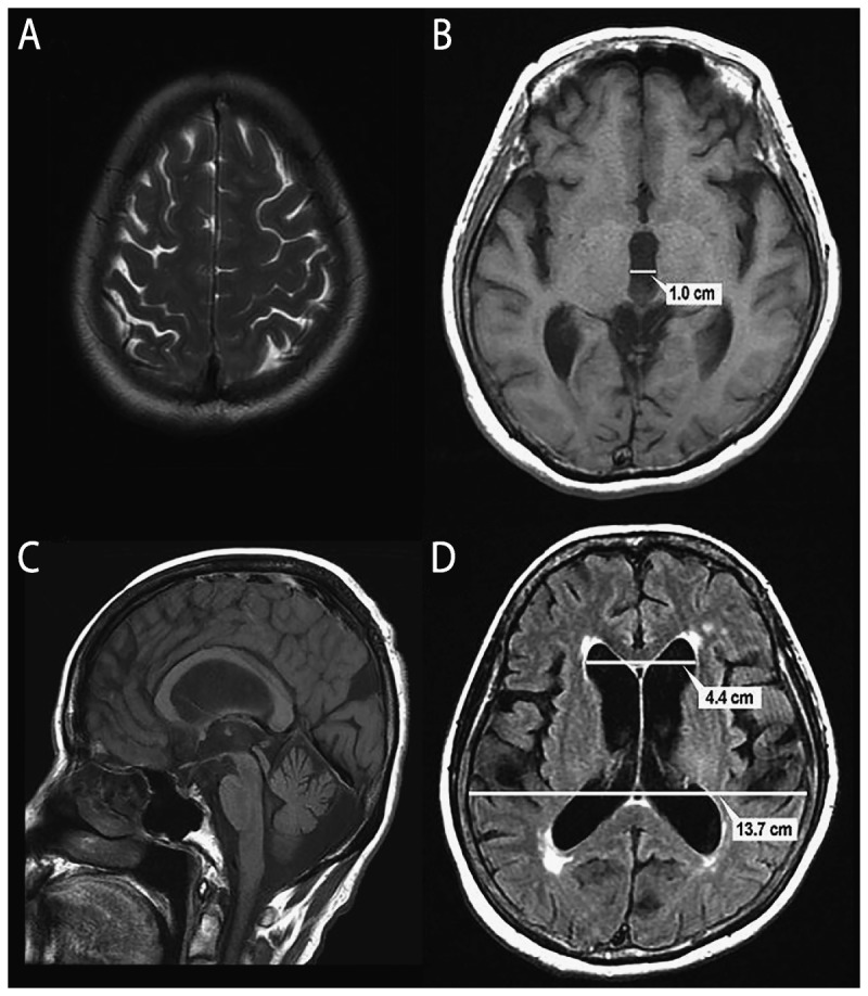 Figure 10-2