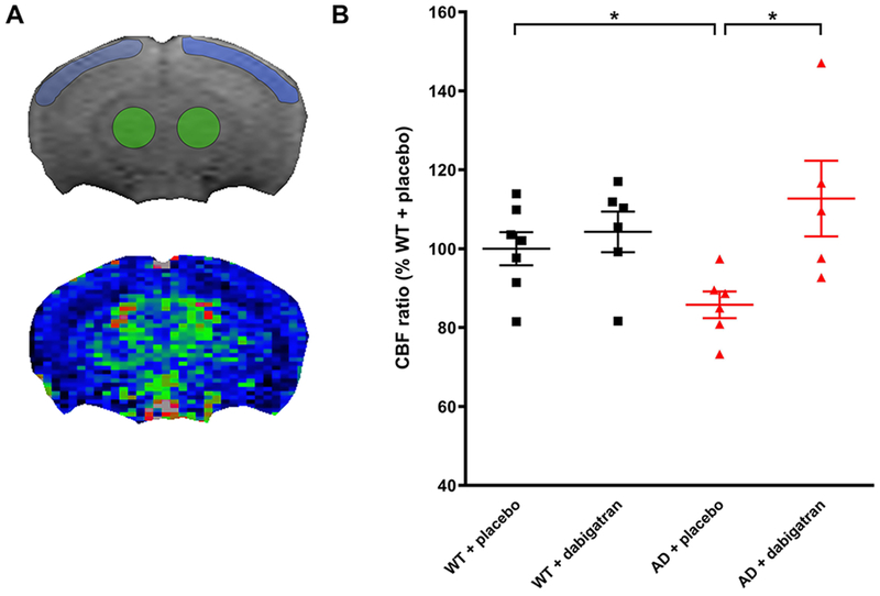 Figure. 3.