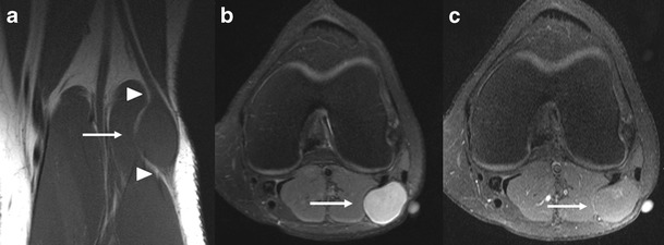 Fig. 12