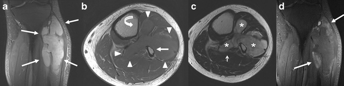 Fig. 14