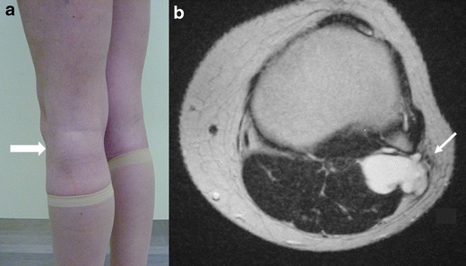 Fig. 16