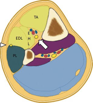 Fig. 5