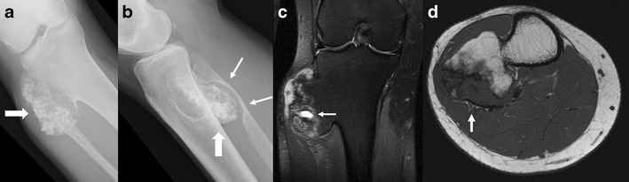 Fig. 15