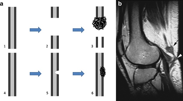 Fig. 10