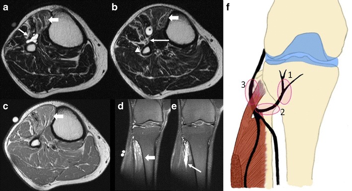 Fig. 11