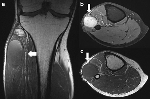 Fig. 13