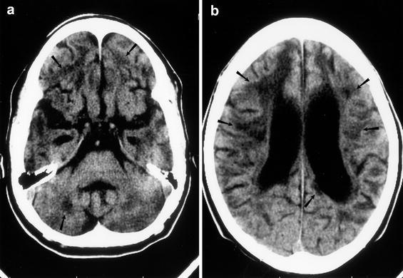 Fig. 3a, b.