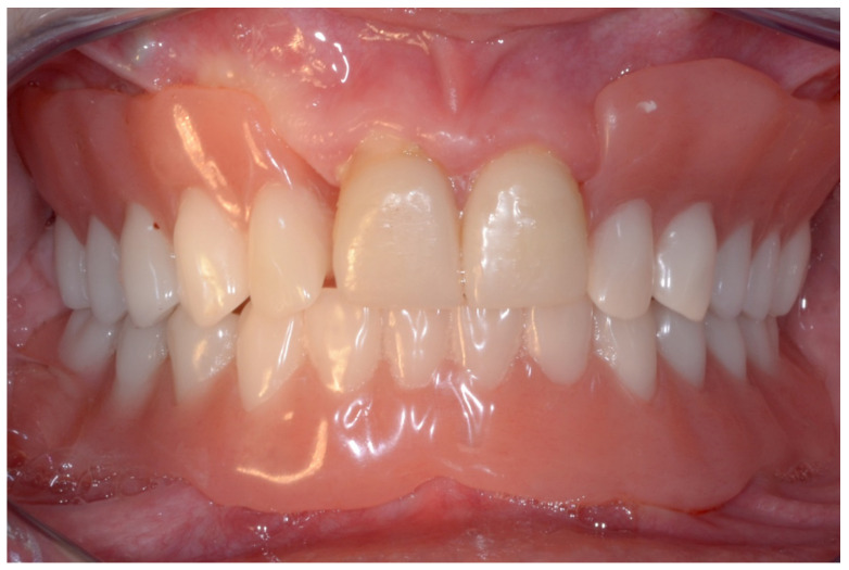 Figure 15