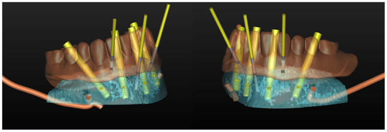 Figure 32
