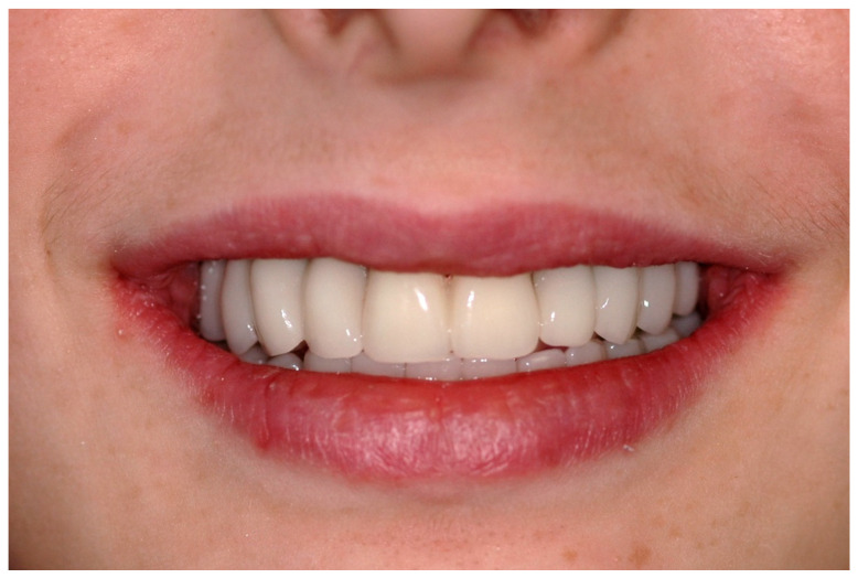 Figure 28