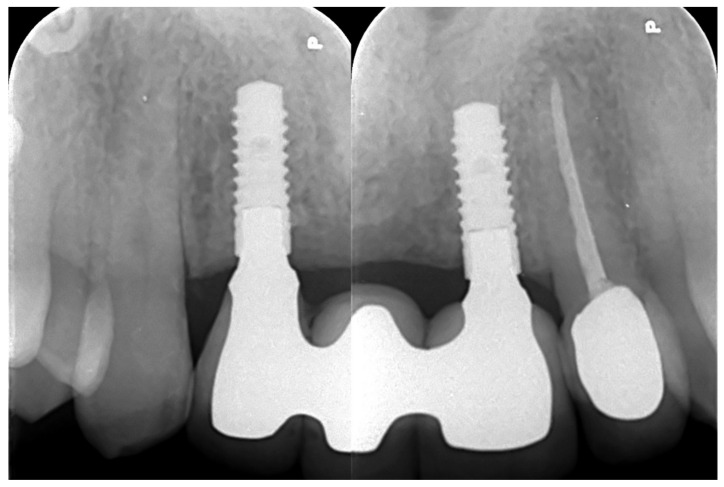Figure 14