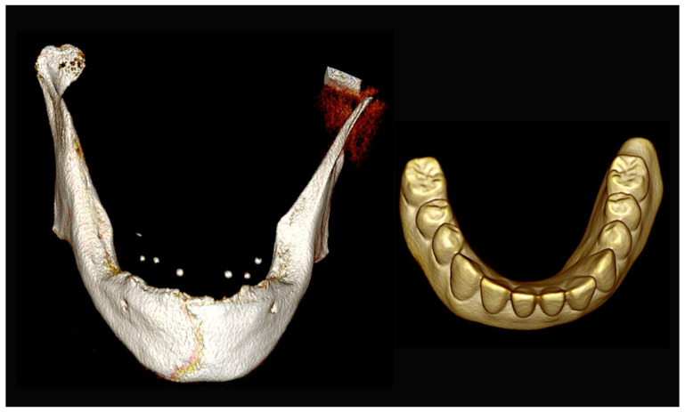 Figure 31