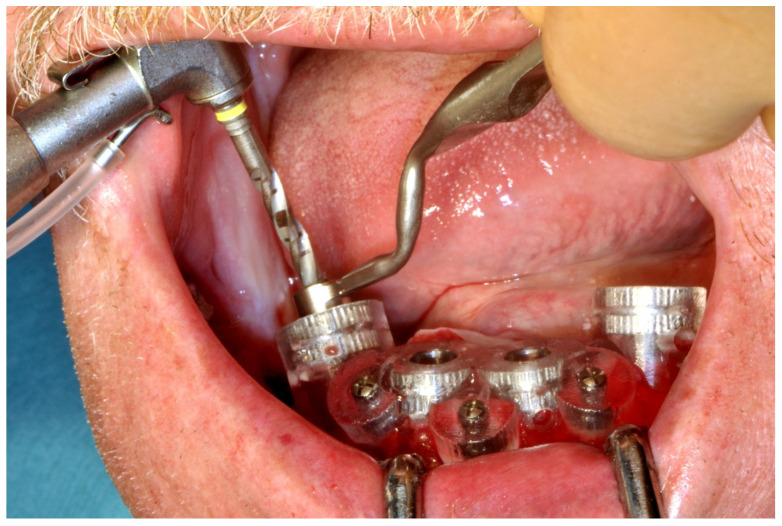 Figure 35