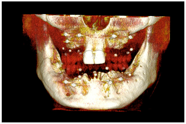 Figure 16