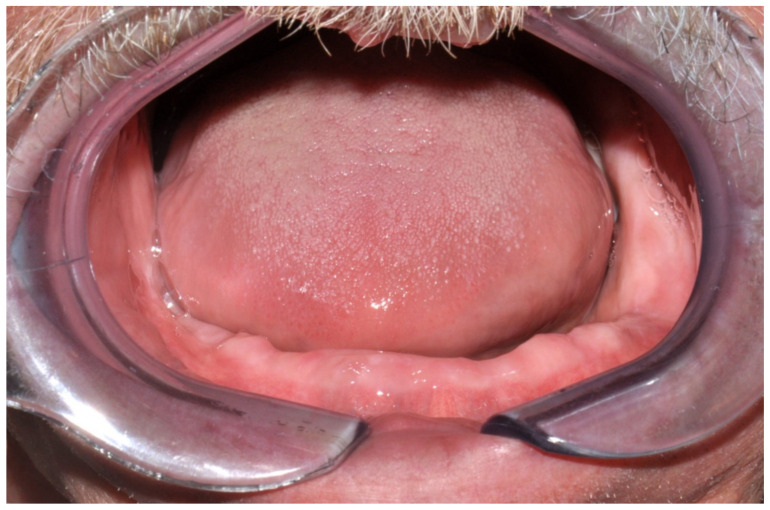 Figure 30