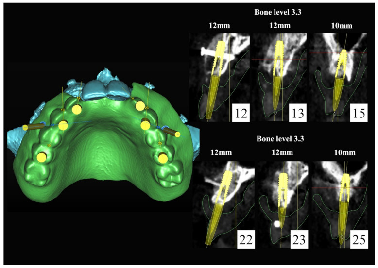 Figure 18