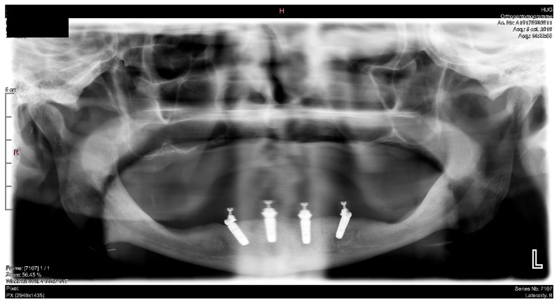 Figure 38
