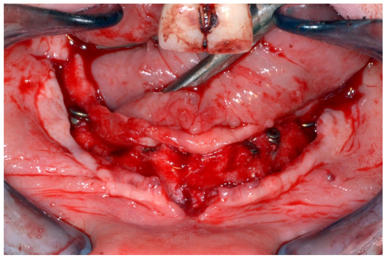 Figure 26