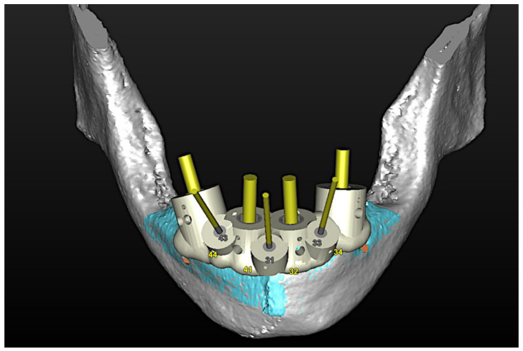 Figure 33