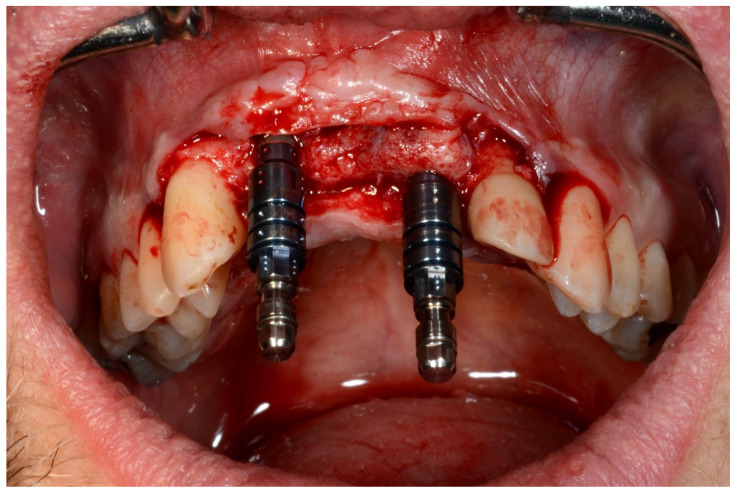 Figure 10