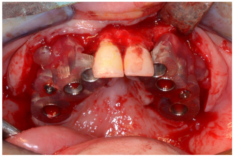Figure 22