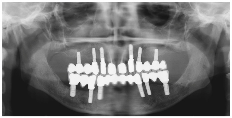Figure 29