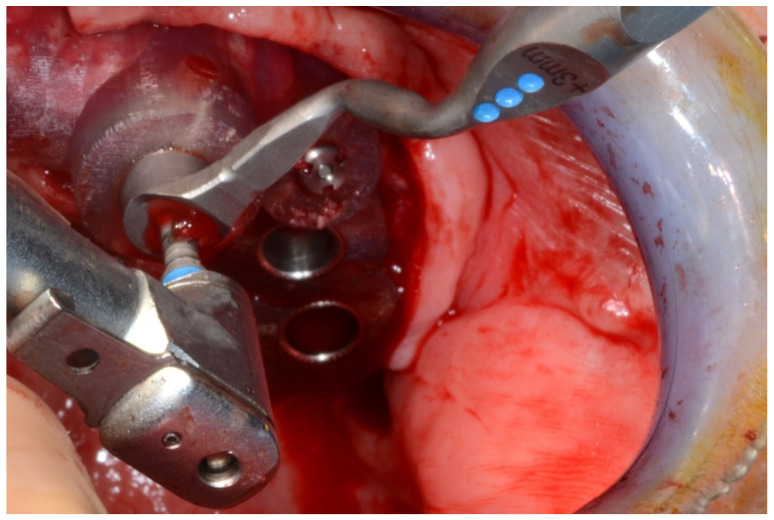 Figure 24