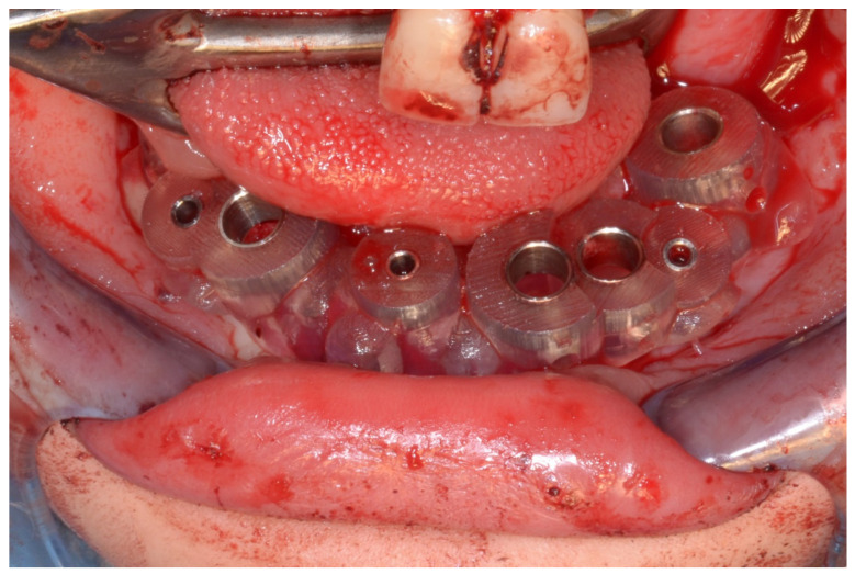 Figure 23
