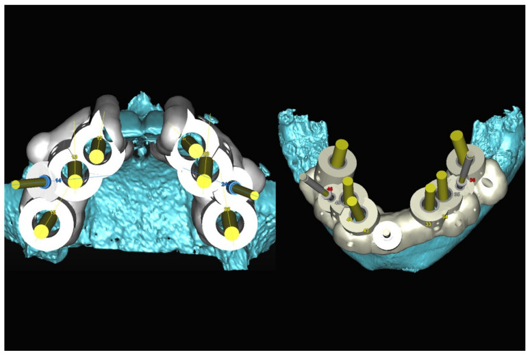 Figure 20