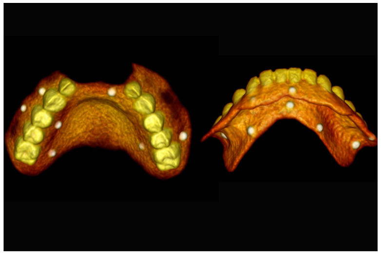 Figure 17