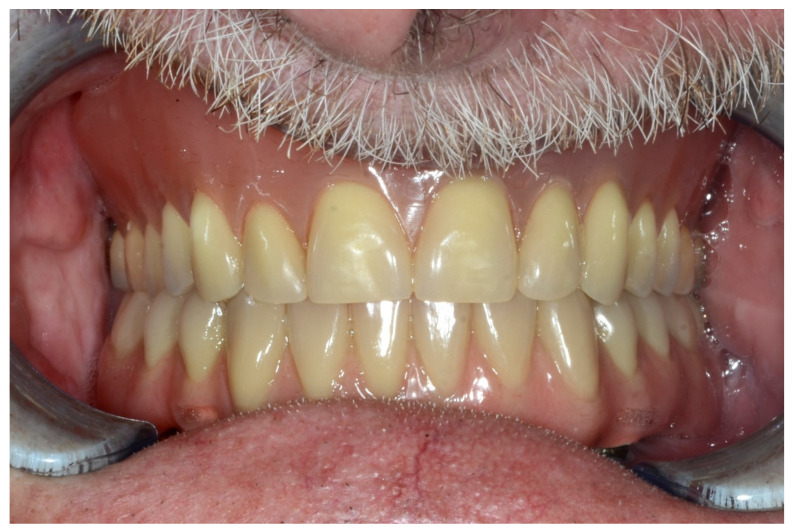 Figure 37