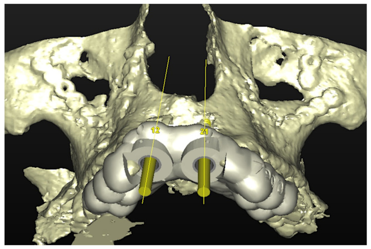 Figure 5