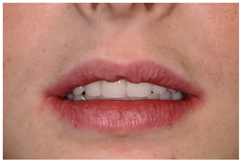 Figure 27