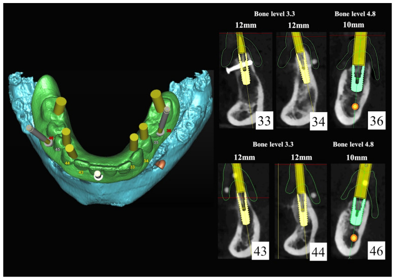 Figure 19