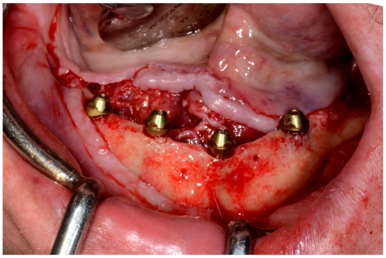 Figure 36