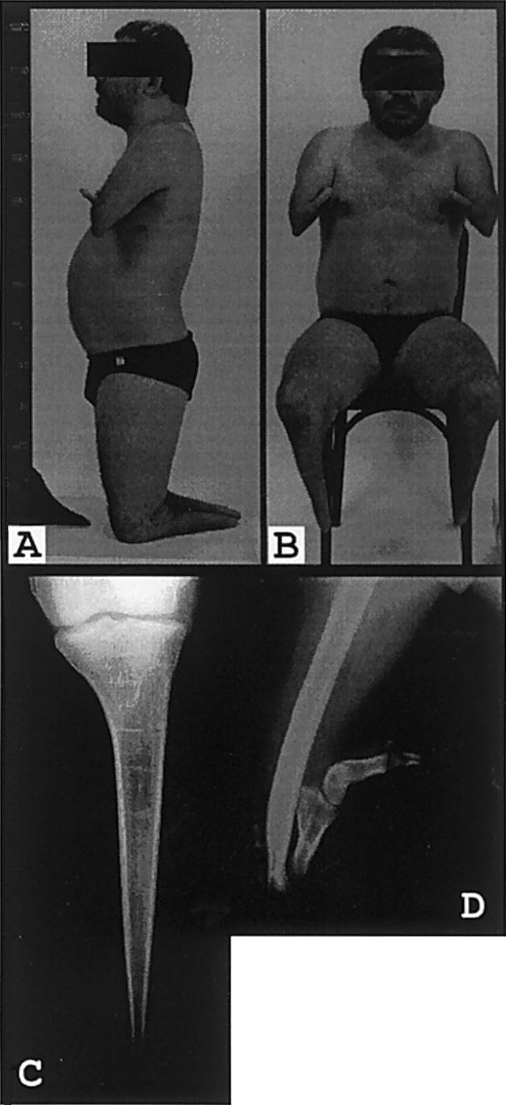 Figure  2