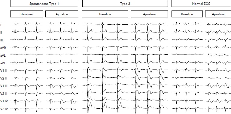 Figure 1: