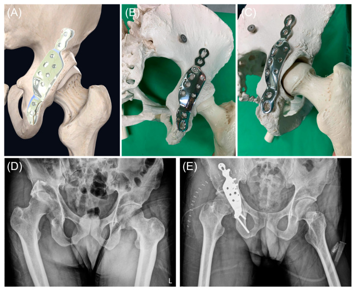 Figure 2