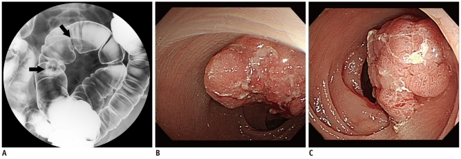 Fig. 3