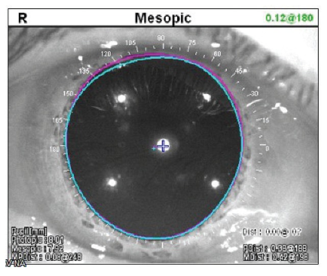 Fig. 4