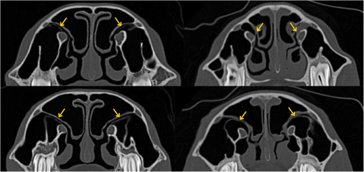 Fig. 3