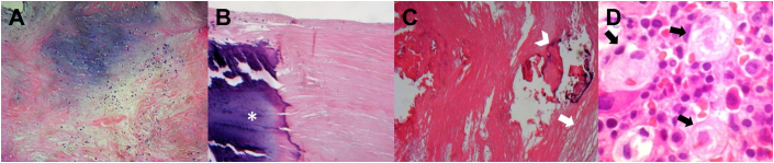 Figure 4