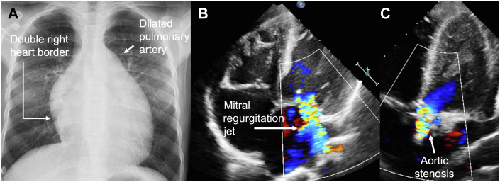 Figure 1