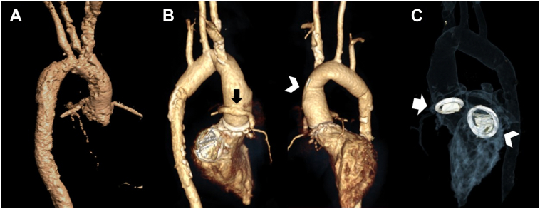 Figure 3