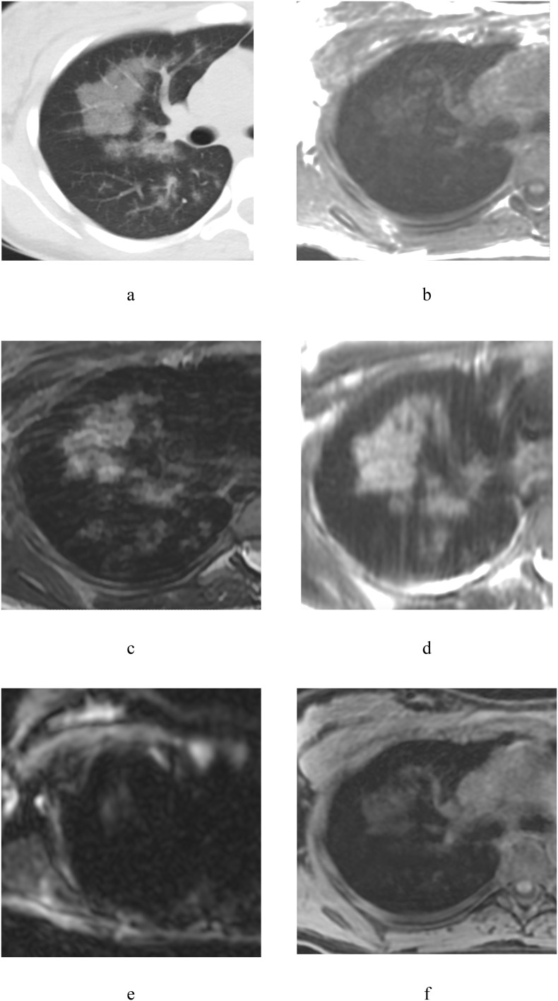 Fig. 5