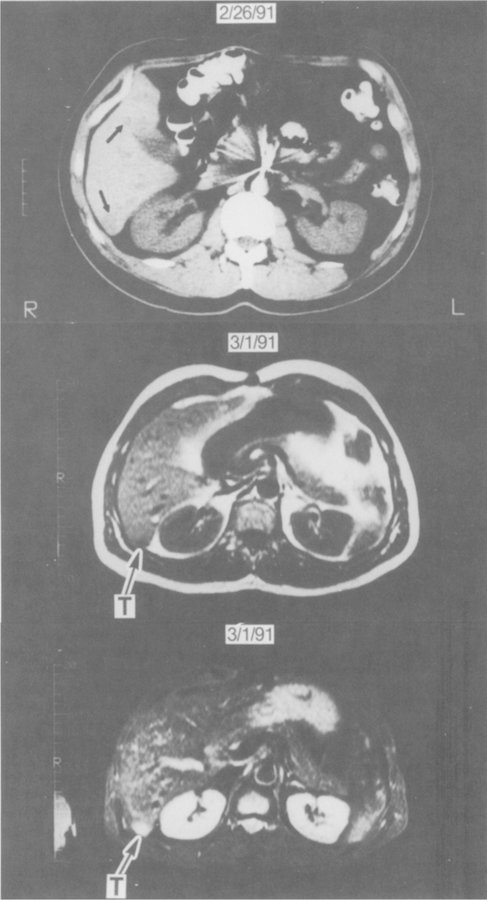 Fig 3.