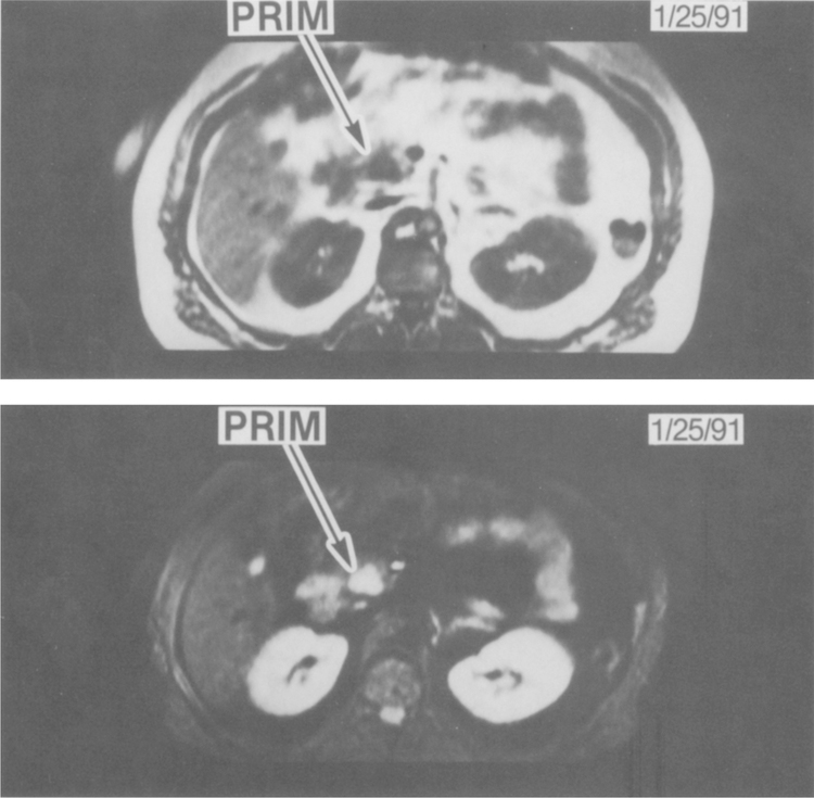 Fig 4.