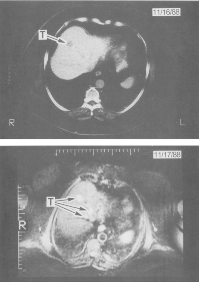 Fig 2.