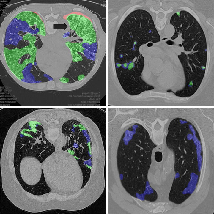 Fig. 8