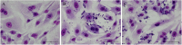 Three-panel image comparing cell samples labeled A, B, and C. Panel A shows several cells with prominent purple-stained nuclei. Panel B shows cells with black granular deposits surrounding the purple nuclei. Panel C displays a similar pattern to Panel B, with scattered purple-stained nuclei and granular deposits.